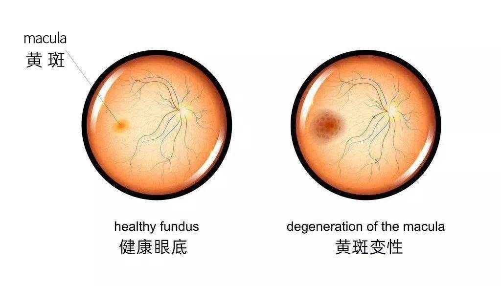 葉黃素對(duì)眼睛真的有效嗎？一文讀懂它的功效與作用(圖3)